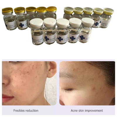 Solução de mesoterapia com ácido hialurónico não cruzado Hyamely 5 ml
