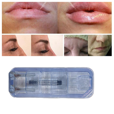 Hyaluronic Acid Lip Filler Injectables 24mg/ml Cuidados Faciais
