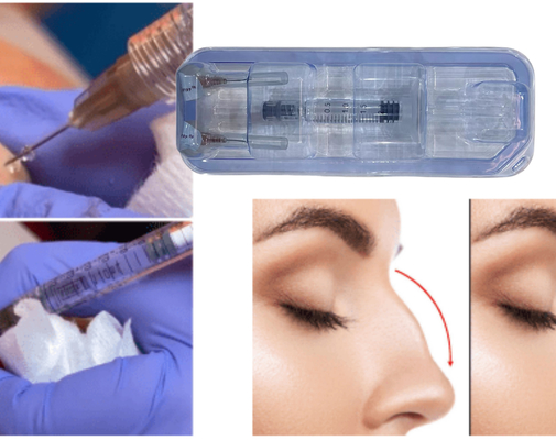 A FDA aprovou injecção de gel de ácido hialurónico para nádegas.
