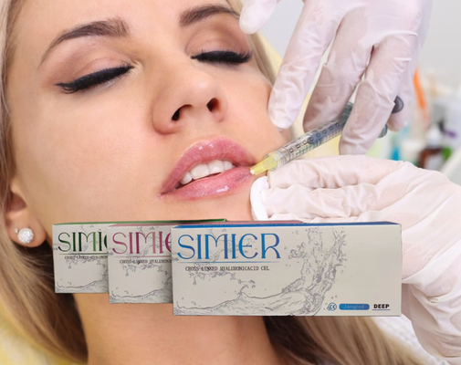 Injecção de Ácido Hialurónico 5 ml 30 mg/ ml Chin Cross Linked Anti- Rugas