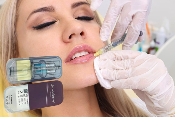 Enchimentos Gel de ácido hialurónico 5 ml Enchimento cutâneo para lábios Injecções Enchimento cutâneo injetável