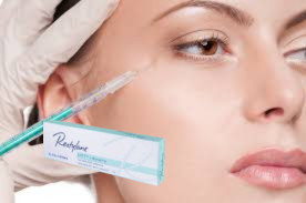 1.1 ml Preenchimento Dérmico Facial Anti- Rugas Preenchimento de Lábios Para Contouramento Facial