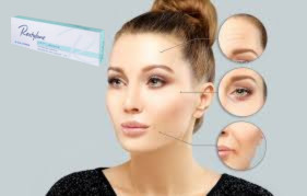 Enchimento cutâneo com ácido hialurónico 1x1.1 ml Enchimento labial