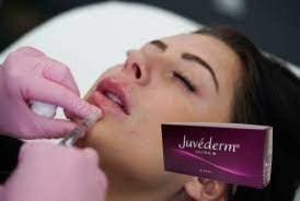 Filler cutâneo de ácido hialurónico de ligação cruzada feminina Juvederm Filler de lábios Ultra 3 Ultra 4
