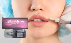 Juvederm Ultra 4 Hyaluronic Acid Lip Fillers Injecções