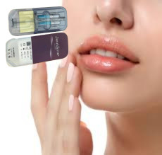 2 X 1 ml Juvederm Ultra 4 Injectação de Enchimento Dermológico Injecções de Enchimento de Lábios