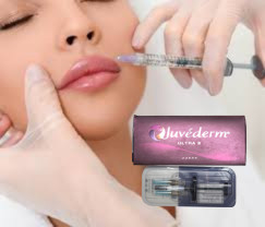 2 X 1 ml Juvederm Ultra 4 Injectação de Enchimento Dermológico Injecções de Enchimento de Lábios