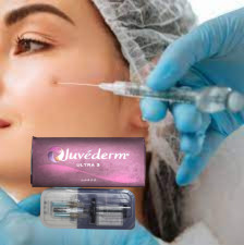 Ultra3 Gel Injetável de Ácido Hialurónico Juvederm Preenchimento Dermológico para Lips Filling