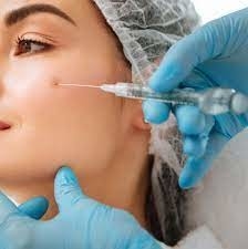 Rugas suaves Preenchimento cutâneo injectável Ácido hialurónico Juvederm Ultra 3 2*1ml